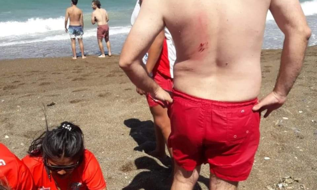 Un hombre fue mordido por un lobo marino en Playa Unión