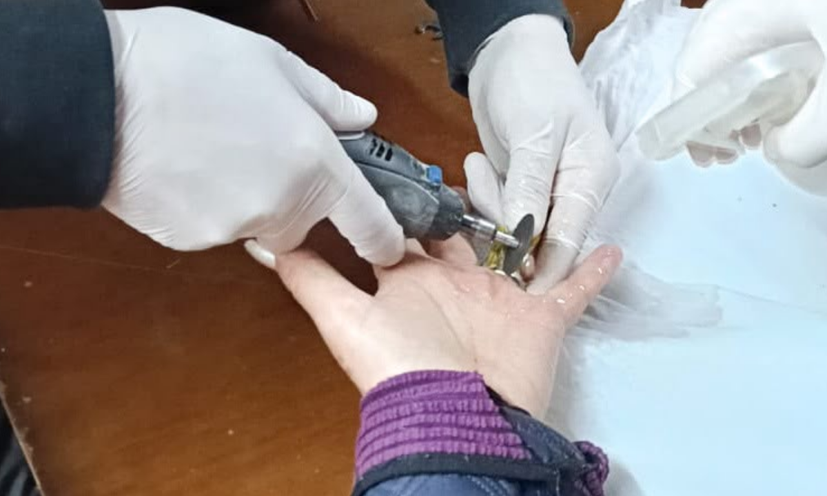 Bomberos Voluntarios de Rawson asistieron a una vecina para retirarle un anillo trabado